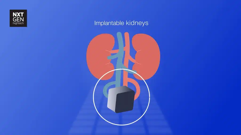 Hightechnl nierstichtingnederland 2d animatie phil en flo 5 - High Tech NL - Nierstichting Nederland - - Phil & Flo Creative Studio