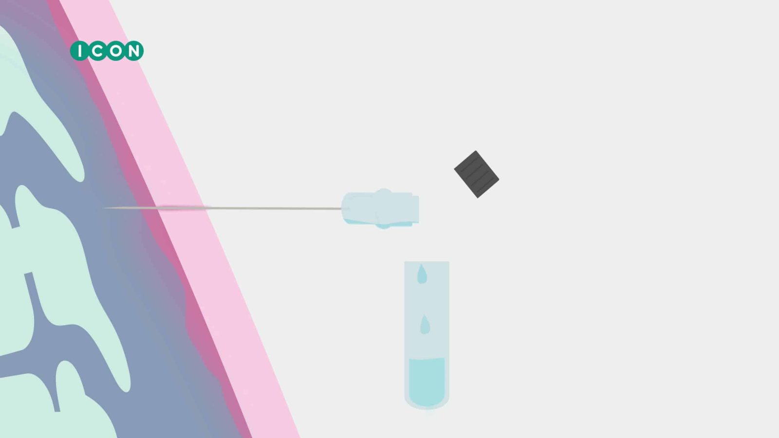 Icon csf 2d animatie phil en flo 1 scaled - Communicatie in de zorg - Geen categorie - Phil & Flo Creative Studio